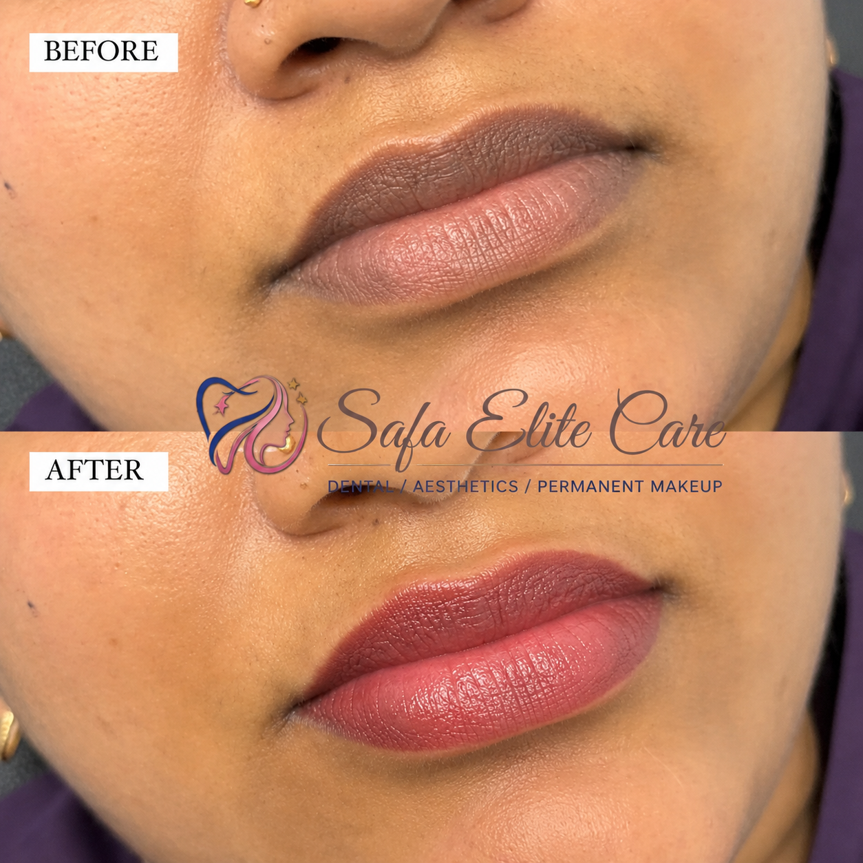 Lip Blush Before & After Results